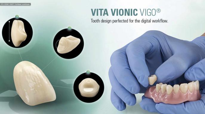 VITA VIONIC VIGO | Anterior