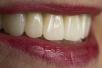 Dentalos Plus Multi | Dents définitives 6-7 ans