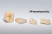 SAGEMAX PressCeramic | MT